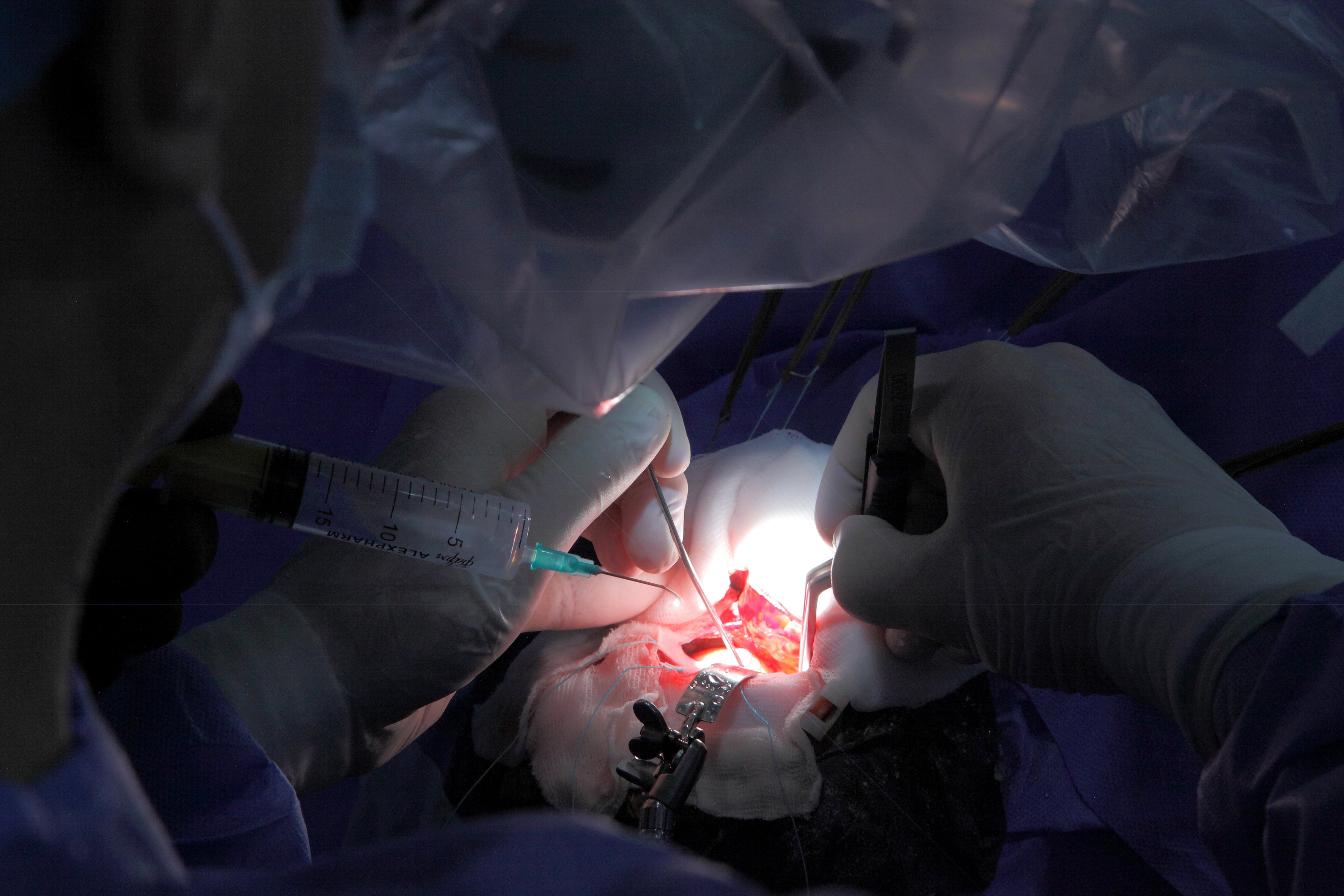 Neurosurgery