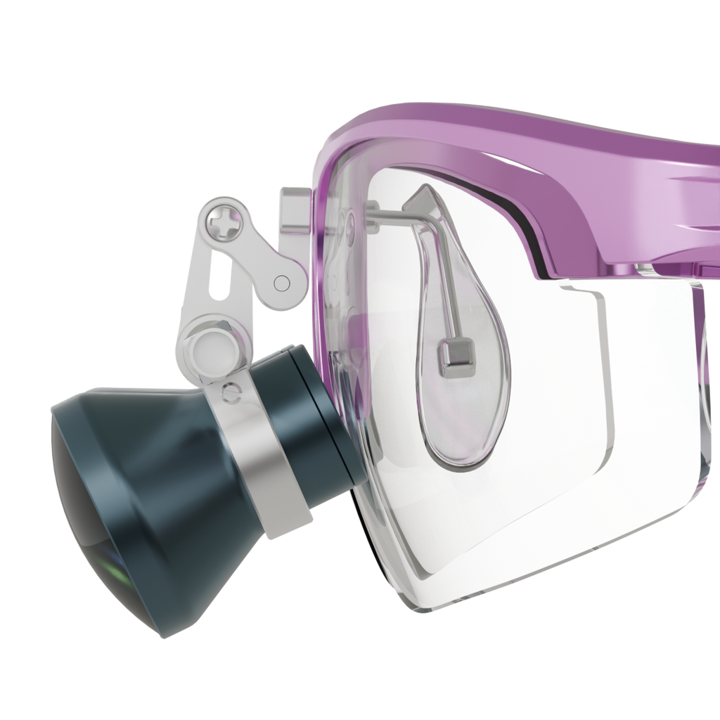 Galilean Vario Loupes: Customized Vision for Dentists – LumaDent